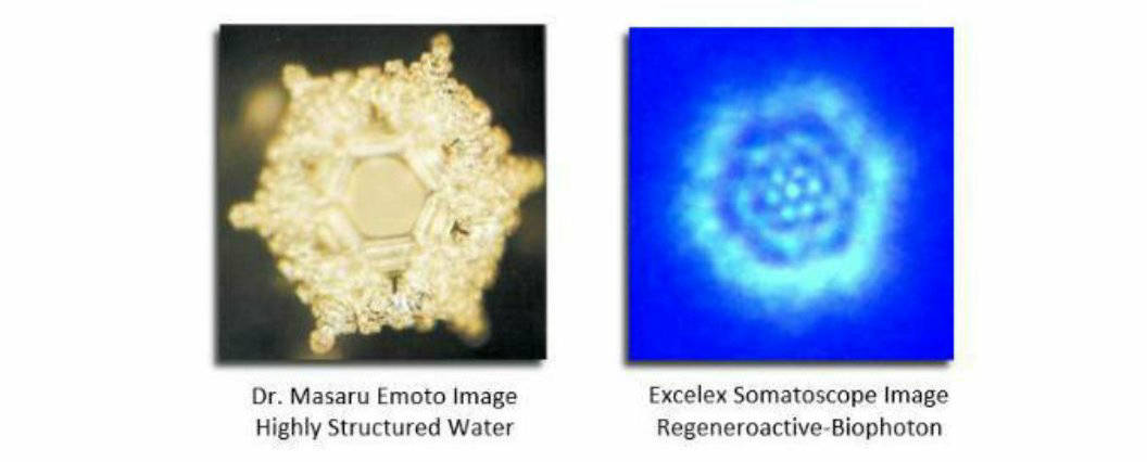Highly Structured Water: Emoto and Excelex Somatoscope Images