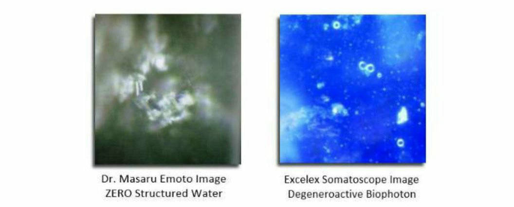 Zero Structured Water: Emoto and Excelex Somatoscope Images