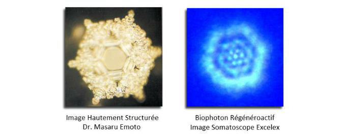 Eau hautement structurée - images Emoto et Excelex Somatoscope 