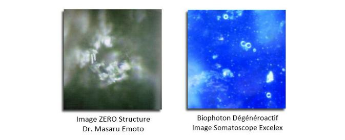Eau sans structure - images Emoto et Excelex Somatoscope
