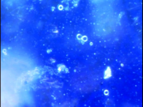 Eau sans structure - Biophotons Dégénéroactifs – Image Somatoscope Excelex