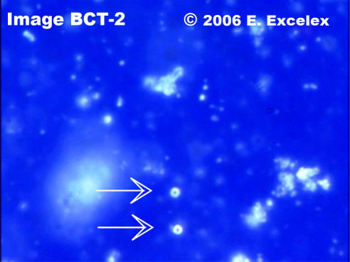 Deux petits biophotons dégénéroactifs dans un concombre âgé trois mois