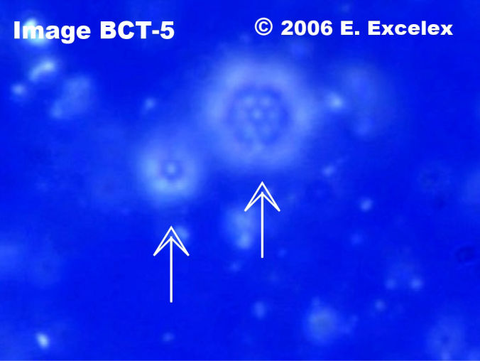 Biophoton Généroactif à côté d'un Biophoton Régénéroactif