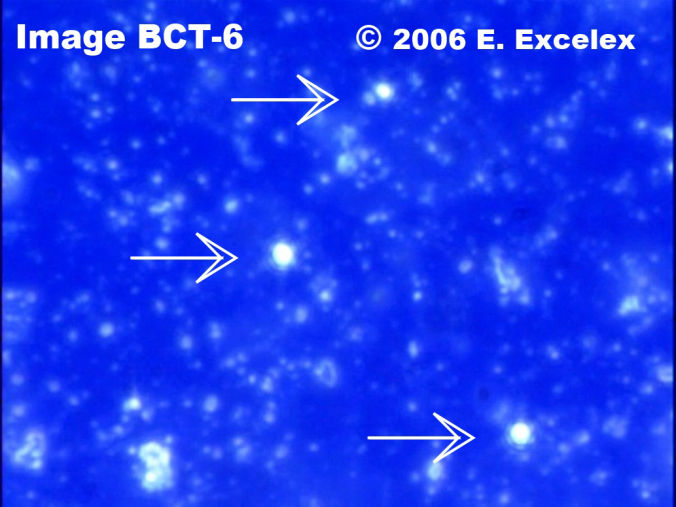 Trois grands biophotons regeneroactifs dans un concombre de trois mois 