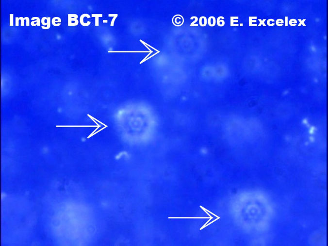 Trois grands biophotons regeneroactifs ouvert
